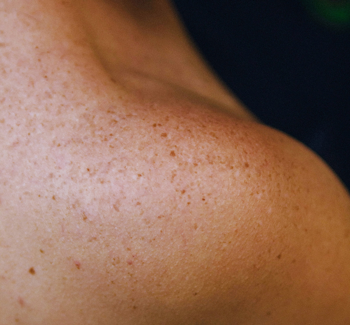 Ingrédients apaisants pour peaux sensibles : des solutions ancestrales pour un confort durable